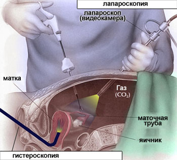 потеря веса при диете аткинса