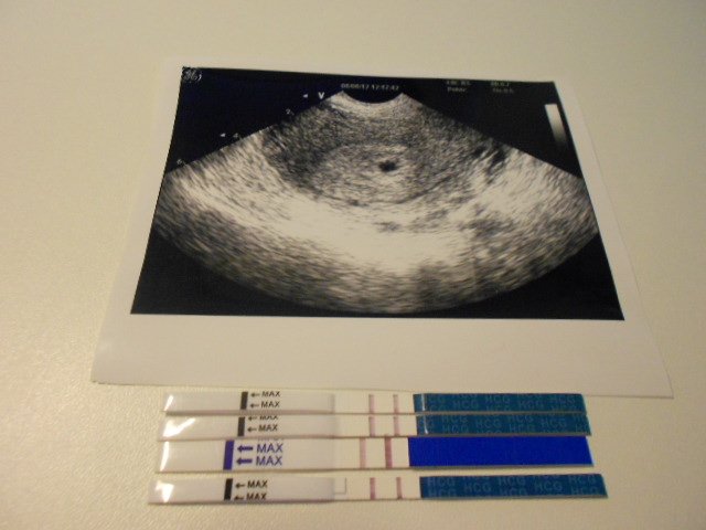 Узи срок 3 недели. УЗИ на 2-4 недели беременности. УЗИ беременности на ранних сроках 1-2 недели. УЗИ 1-2 недели беременности на ранних сроках беременности. УЗИ 3 недели беременности от зачатия.