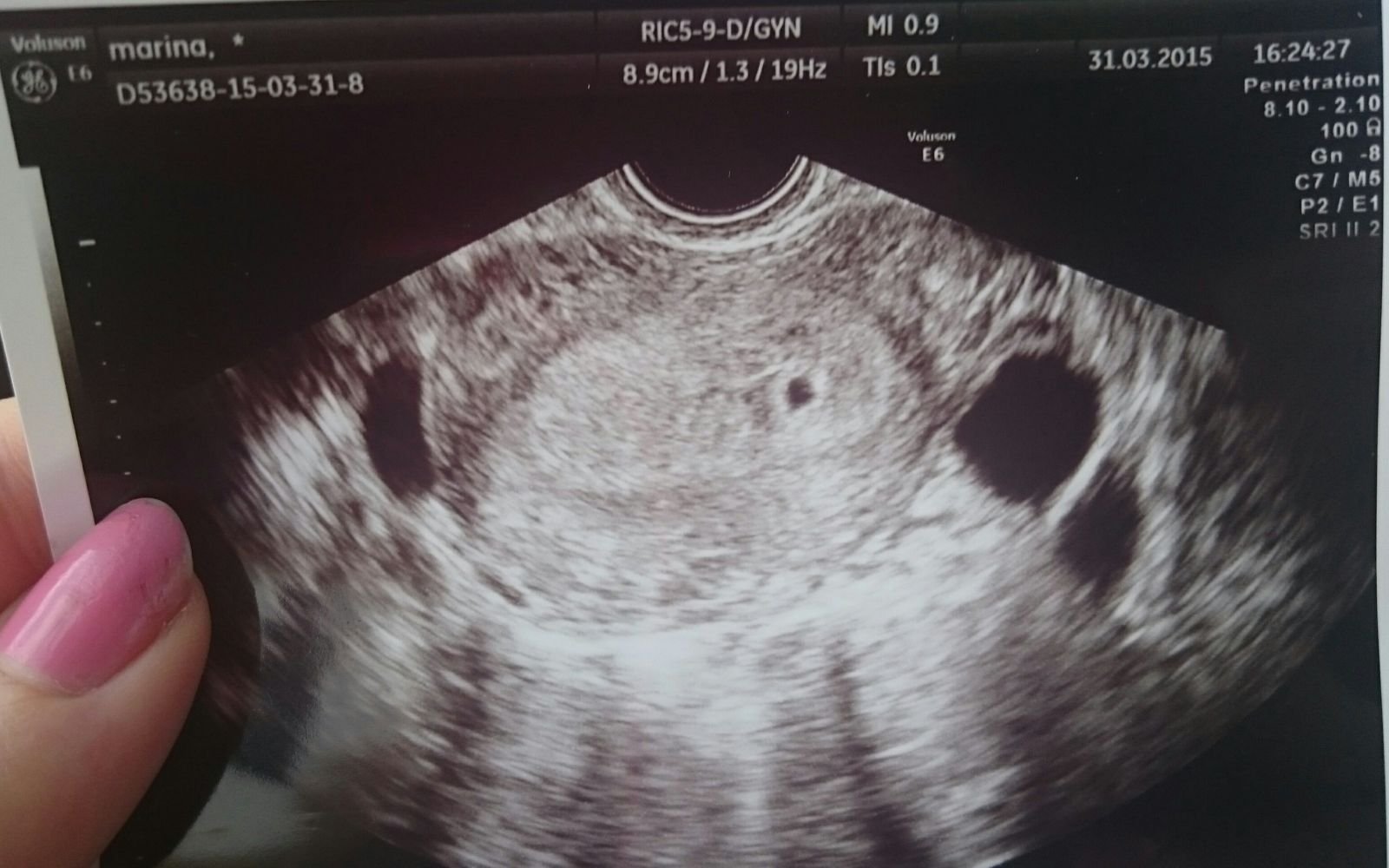 Узи 3 4 недели. Снимок УЗИ 2-3 недели беременности. УЗИ 4 недели беременности. УЗИ на 2-4 недели беременности. Эмбрион на 4 неделе беременности УЗИ.