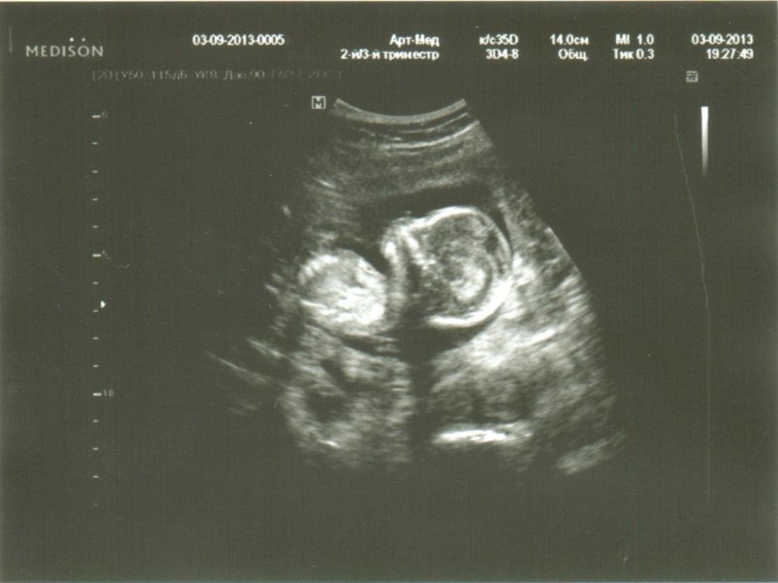 Шестнадцати недель. Размер эмбриона 16 недель. 16 Недель размер ребенка.