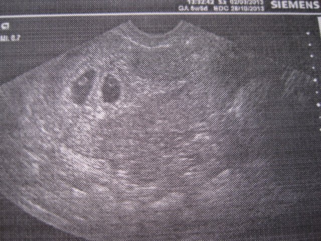 4 недельки от зачатия