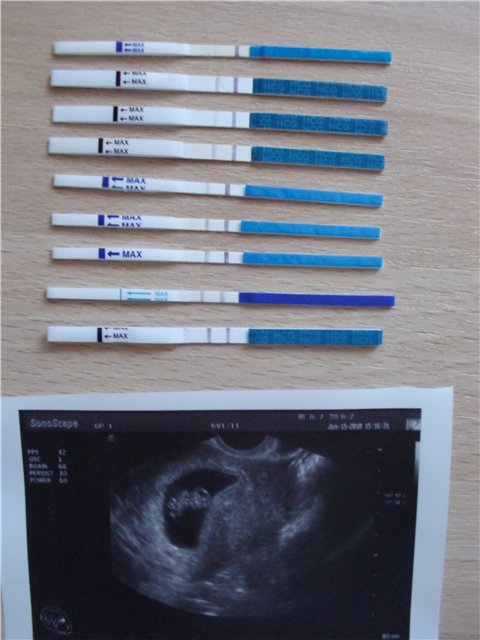 8 недели задержки. УЗИ 1 недели беременности до задержки. Тест на беременность УЗИ. УЗИ может показать беременность. Снимок УЗИ беременности и тест на беременность.