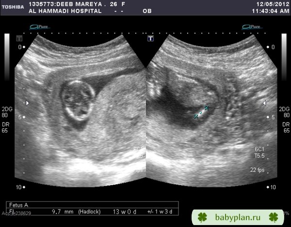 12 weeks!!!