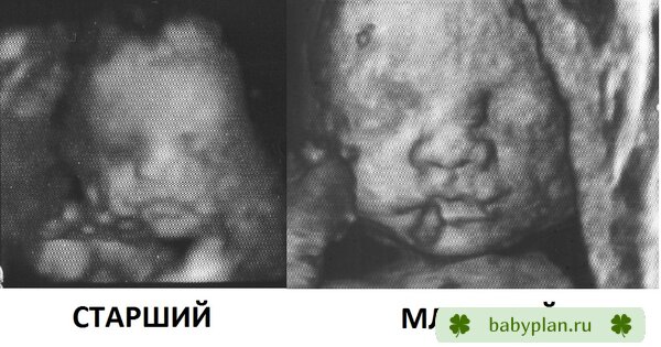 старший и младший братики на сроке 26-27 нед.)