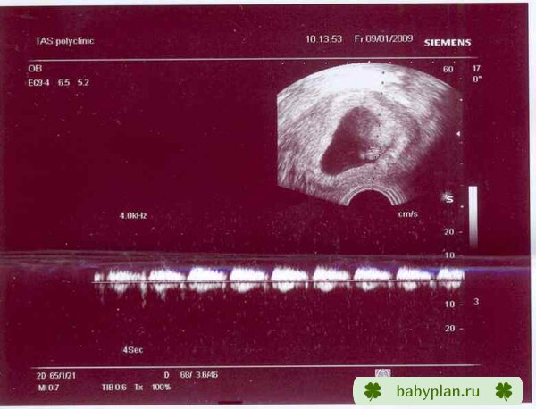 наш малыш, 5 нед от зачатия, 8 мм