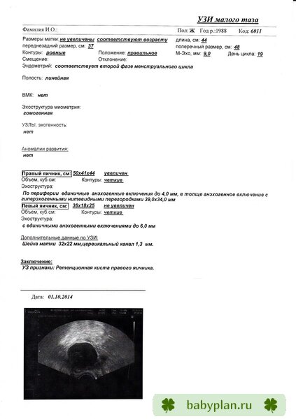 УЗИ 01.10.2014г. обработка