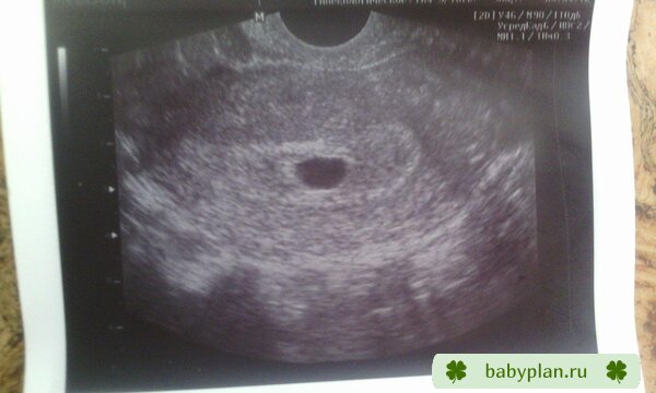 6 недель от посл. мес (1 марта) эмбрион четко не визуализируется
