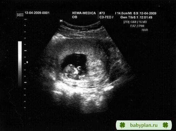 Малыш сосет кулачок, беременность 12 недель 3 дня, малышу 10 недель 3 дня.