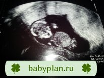 12 неделек