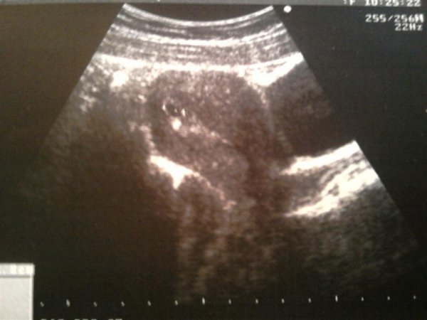 УЗИ - 3 недели от зачатия, может больше на несколько дней.