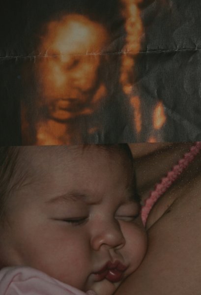 До и после родов
