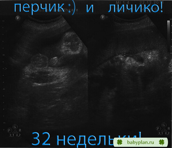 сладкому малявочке 32 недельки!!!!