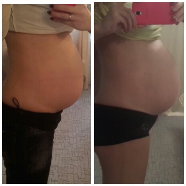 33 недели справа, а на фото слева на 10 дней раньше.