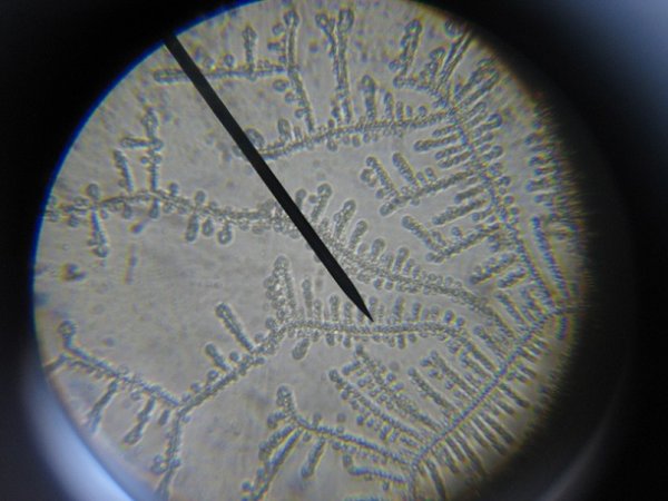 тест на овуляцию " рисунок слюны под микроскопом"