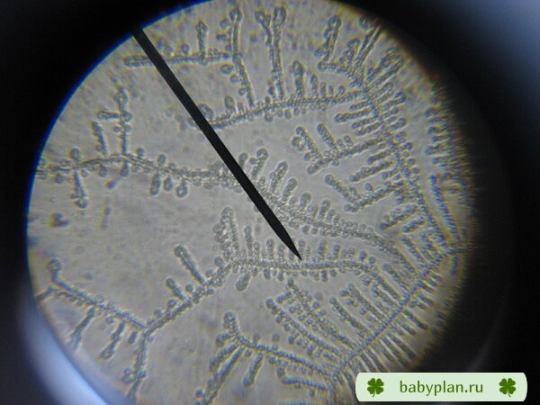 тест на овуляцию " рисунок слюны под микроскопом"