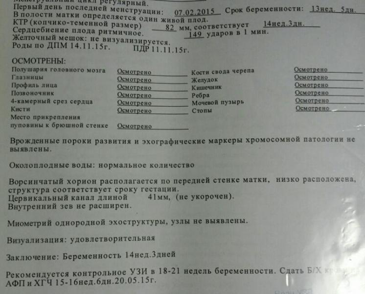 Почему узи не видит. УЗИ на 6 неделе беременности сердцебиение. 6 Недель беременности сердцебиение плода на УЗИ. УЗИ 5-6 недель беременности сердцебиение. УЗИ 12 недель беременности сердцебиение плода.