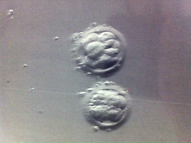 Розовые выделения дпп. После подсадки эмбриона коричневые выделения. Выделения с запахом после подсадки эмбриона. Выделения на 7 день после переноса эмбрионов при эко. Жжиженные выделения после переноса.