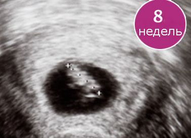 8 недель беременности