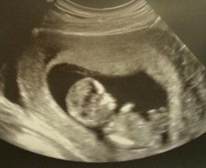 post-202935-0-96409000-1419364763_thumb.jpg