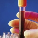 Как сдавать тест на торч инфекцию анализ крови и маркеры