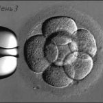 Подробная информация о "Двойной перенос эмбрионов"