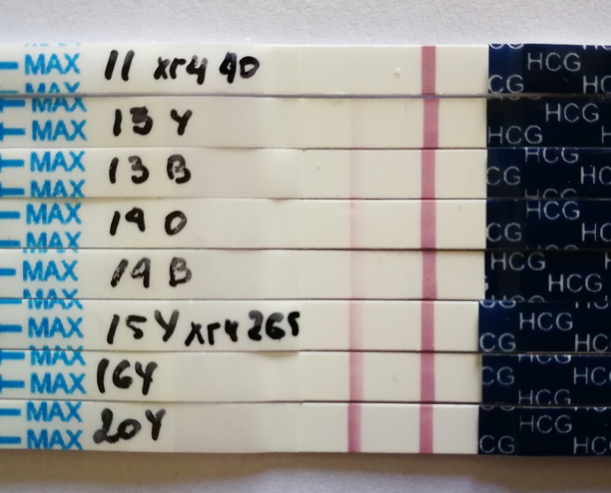 Криоперенос 5 дневных. Тесты после переноса трехдневок. Динамика тестов после криопереноса. Тест после подсадки 5 дневок. Тесты после криопереноса.