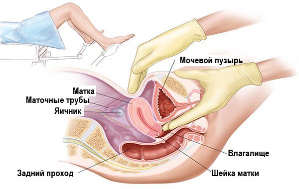 Как делают гинекологический массаж