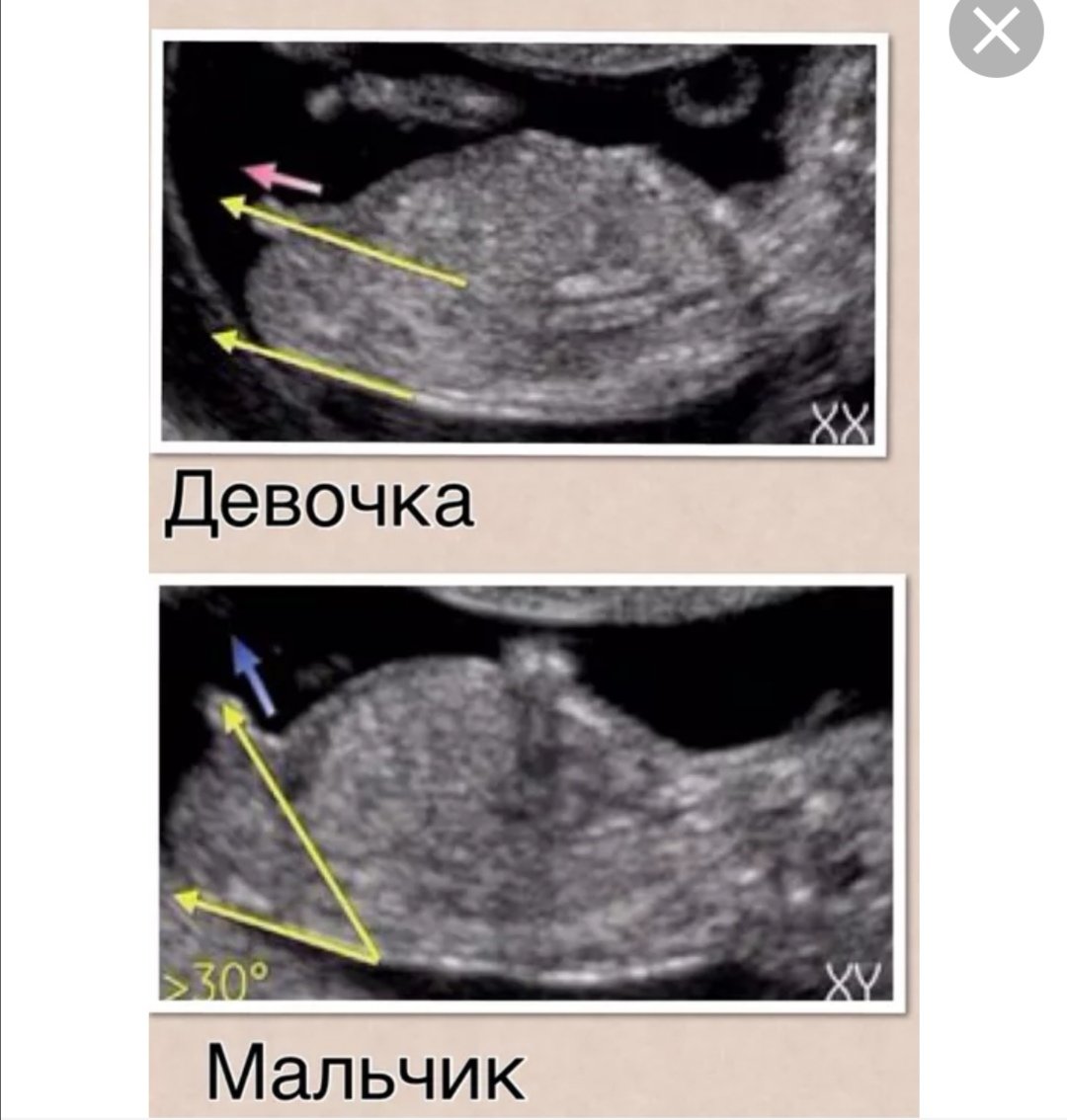 Фото мальчика 12 недель