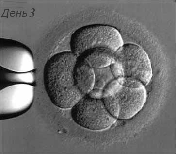 dvojnoj-perenos-embrionov.jpg