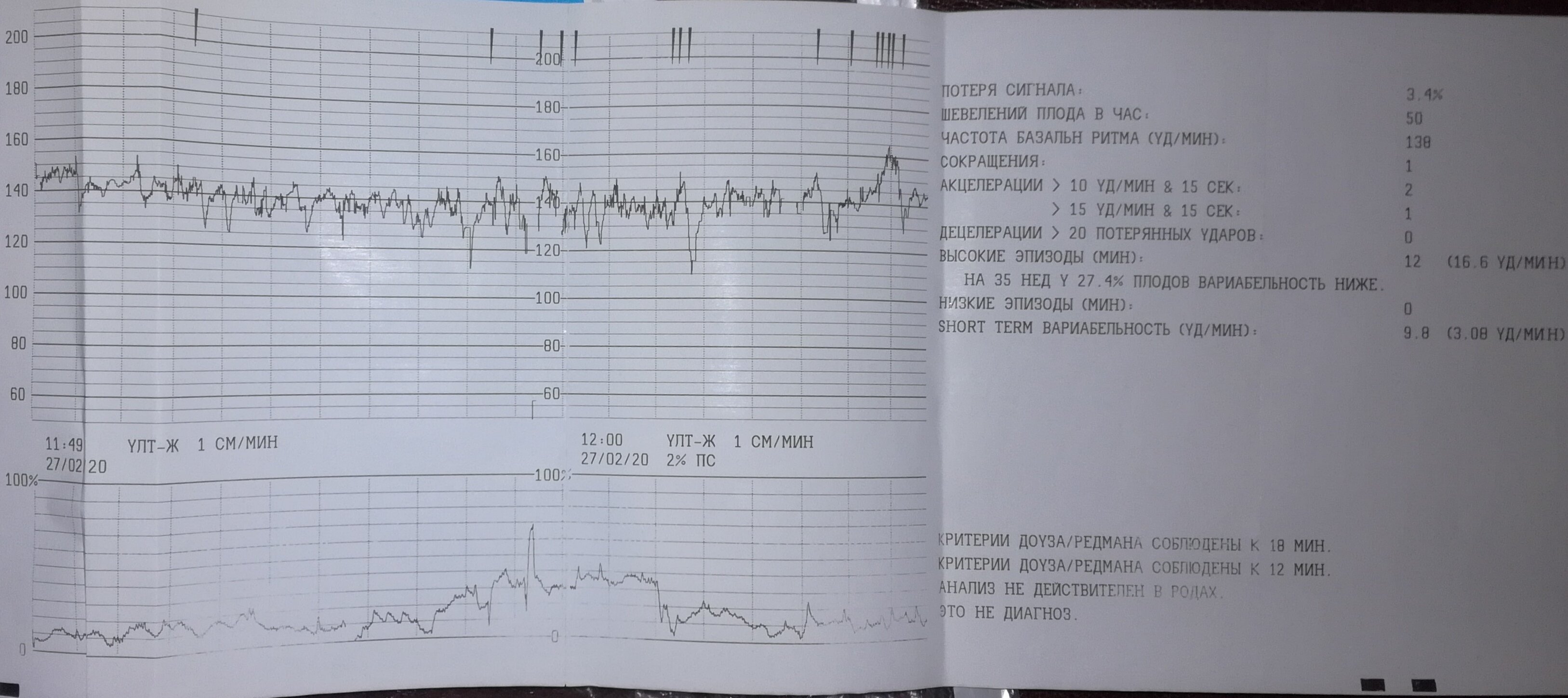 Шевеления на 35 неделе