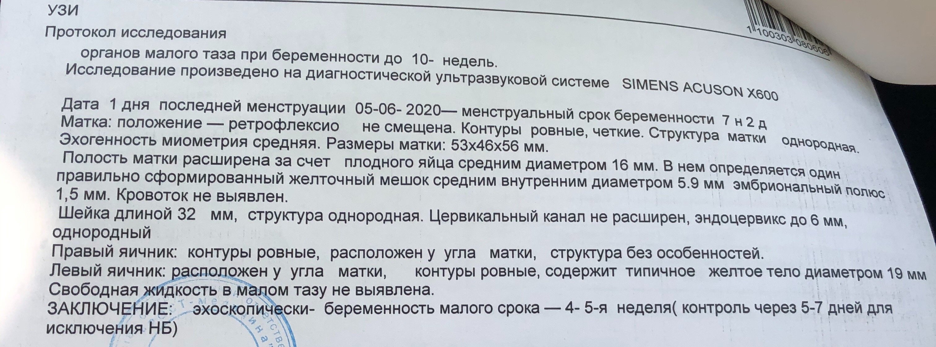 На неделю меньше срока на узи. Срок 5 недель беременности. Срок беременности 5-6 недель. Протокол УЗИ малого таза. Диаметр желточного мешка 5,4 мм.