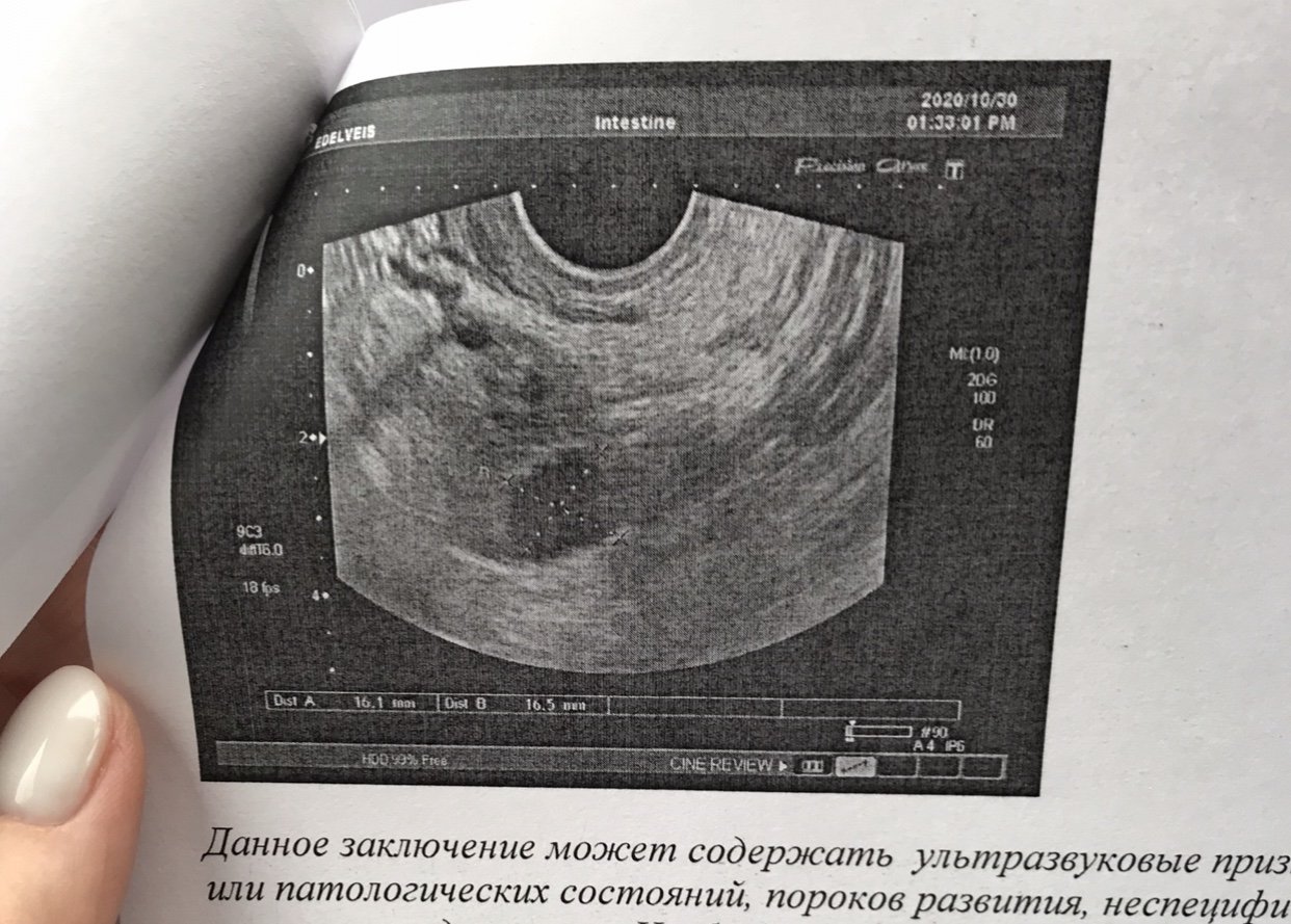 Фото Узи Реально Фото Узи Реально