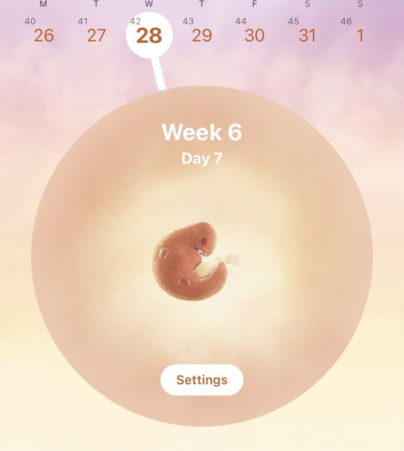 Выделения срок 7 недель. Коричневые выделения на 6 неделе беременности. Выделения на 6 акушерской неделе. Коричневые выделения 13 акушерская неделя беременности. 7 Недель мажется коричневым.