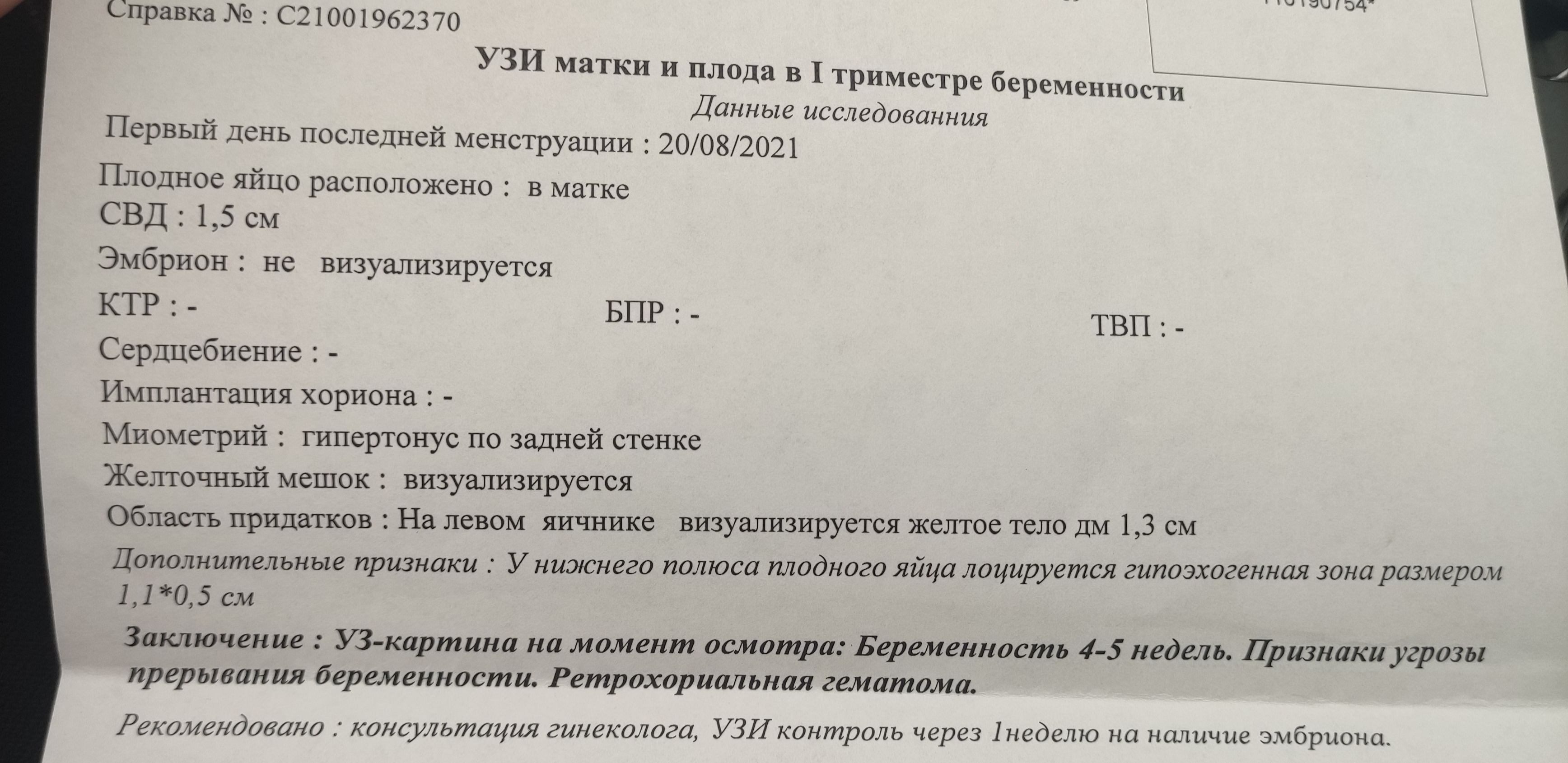 Гематома 6 недель. Ретрохориальная гематома УЗИ заключение. УЗИ В 5-6 недель беременности гематома. УЗИ беременность 6 недель с гематомой. Гематома на УЗИ В 8 недель беременности.