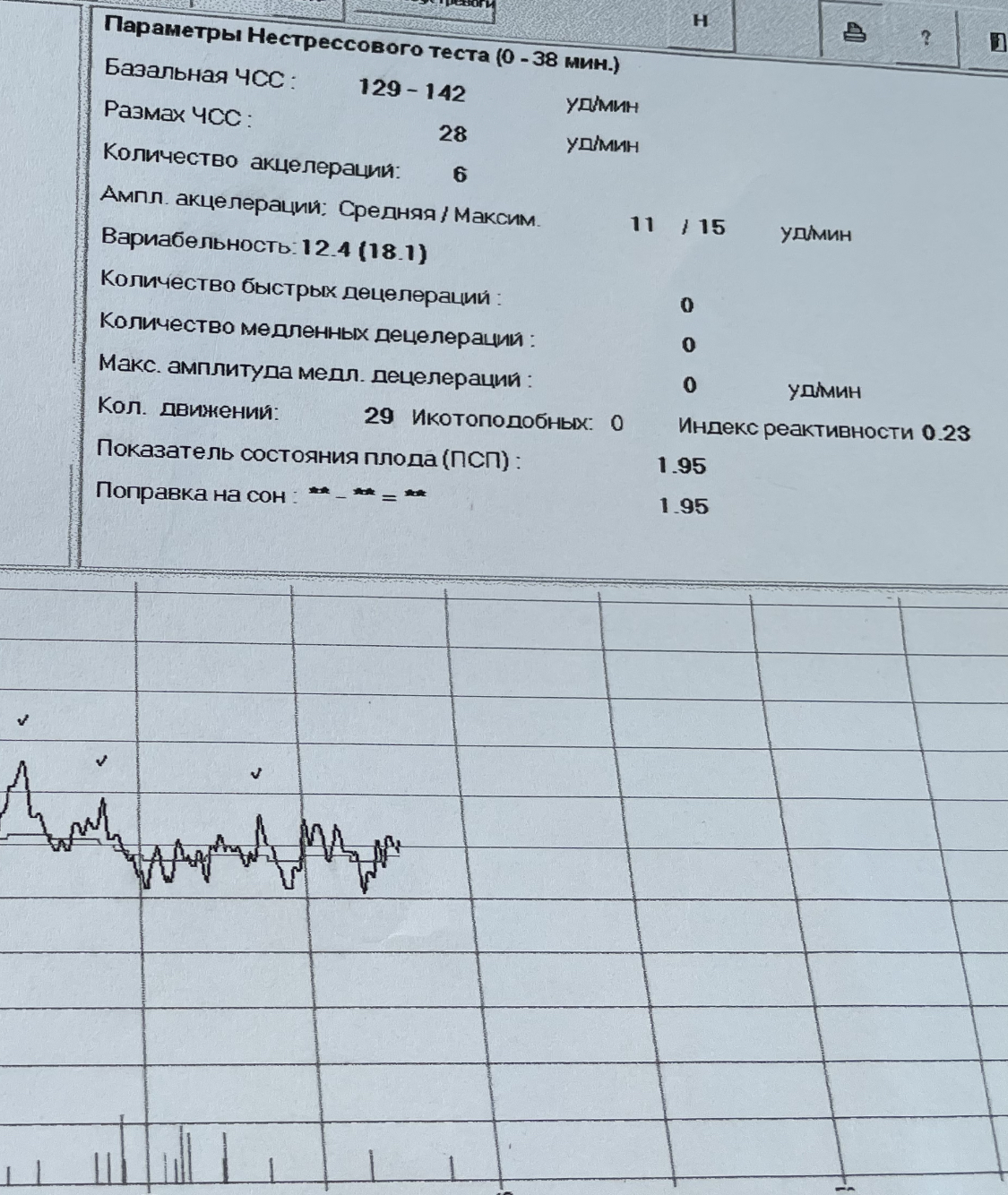 Ктг сколько