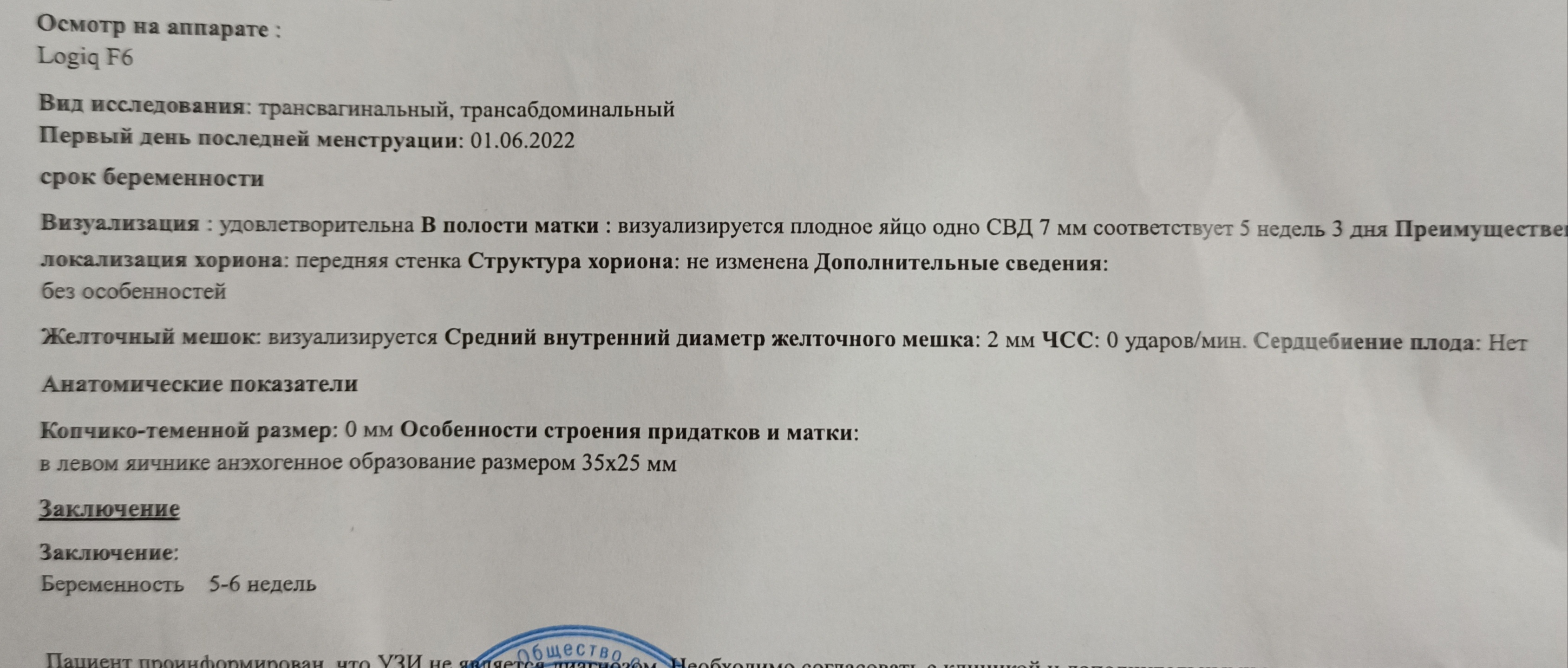 8 недель нет сердцебиения. Срок беременности по УЗИ. УЗИ 6 недель беременности. Беременность 6 недель эмбриона нет спроси врача. Плодное яйцо есть а эмбриона нет почему.